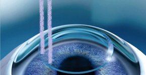 مقابلة مع دكتور فضل مرزوق